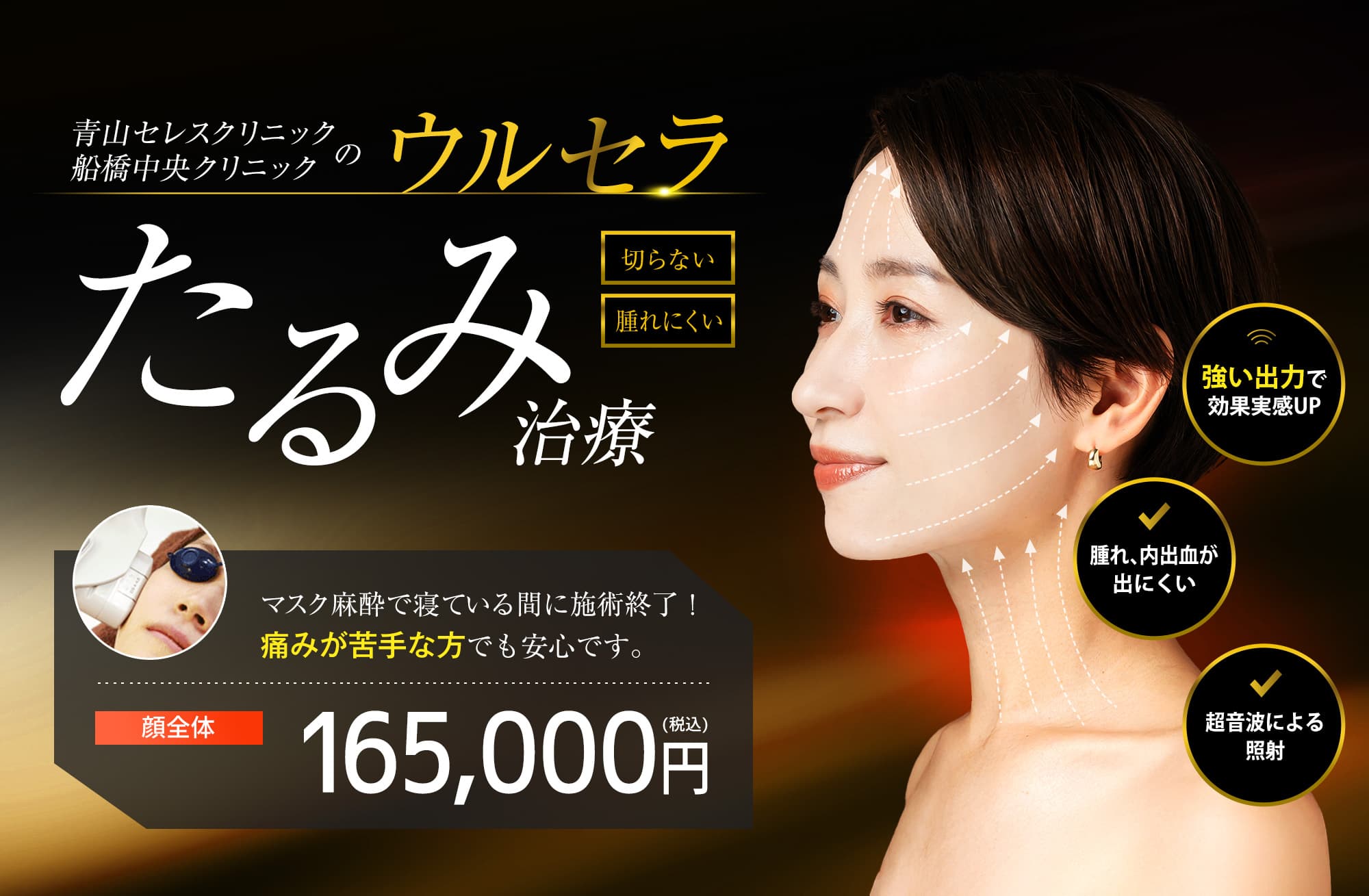 青山セレスクリニック、船橋中央クリニックのウルセラ 切らない 腫れにくい たるみ治療 マスク麻酔で寝ている間に施術終了！痛みが苦手な方でも安心です。 顔全体 165,000円（税込）